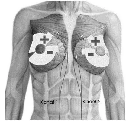 elektrody tenscare do elektrostymulacji piersi