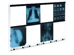 Negatoskop NGP 80 HF