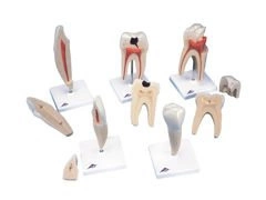 Klasyczne modele zębów 5 sztuk D10