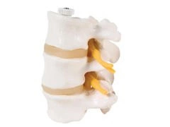 Model trzech kręgów lędźwiowych A76/8