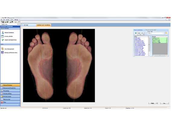 Podoscan 2D FootCAD