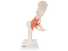 Model funkcjonalny stawu biodrowego A81/1