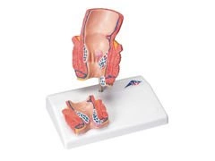 Model odbytnicy z hemoroidami K27