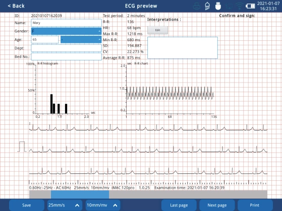 Zoncare iMAC 12 - aparat EKG 