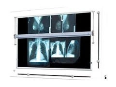 Negatoskop żaluzjowy do mammografii NGP-41 mZU