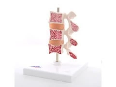 Model osteoporozy (3 kręgi) A78