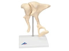 Model kosteczek słuchowych z otosklerozą A101