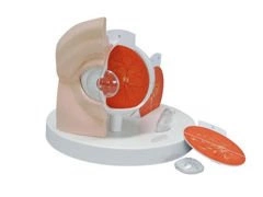 Model chorego oka F17