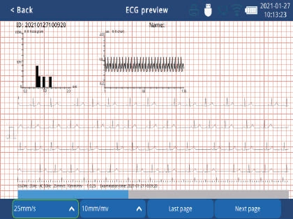 Zoncare iMAC 300 - Aparat EKG 