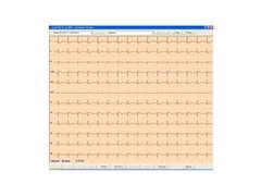 ASPEL ECG CARDIOTEKA v.211SOFT - Oprogramowanie