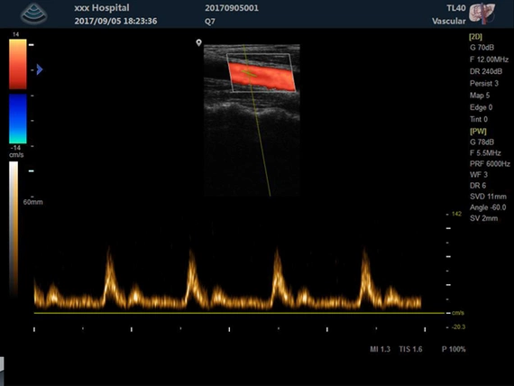 Aparat ultrasonograficzny Zoncare M5 z głowicą convex