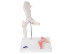 Mini staw biodrowy z przekrojem poprzecznym A84/1