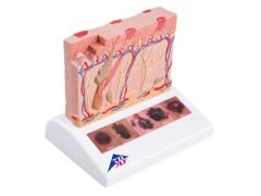 Model raka skóry J15