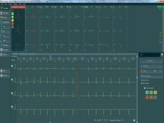 Oprogramowanie do holtera EKG BTL Cardiopoint Holter H100