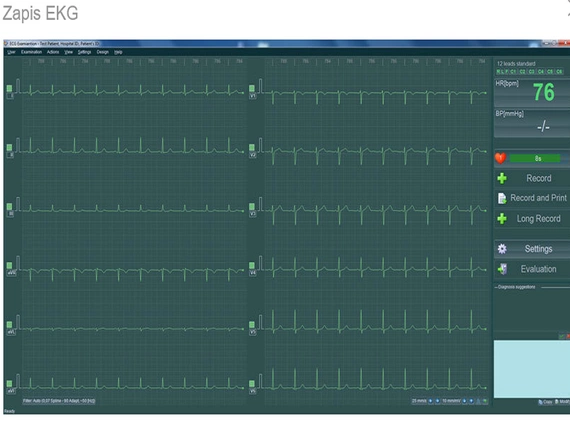 BTL CARDIOPOINT® EKG C300