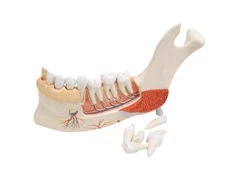 Model połowy żuchwy z chorymi zębami VE290