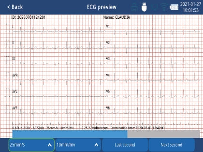 Zoncare iMAC 300 - Aparat EKG 