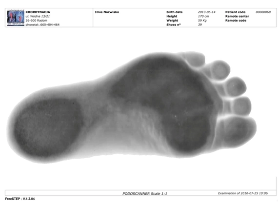 Podoscan 2D FootCAD