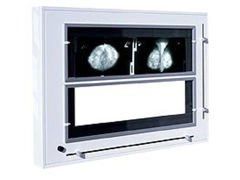 Negatoskop żaluzjowy do mammografii NGP-31 mZ