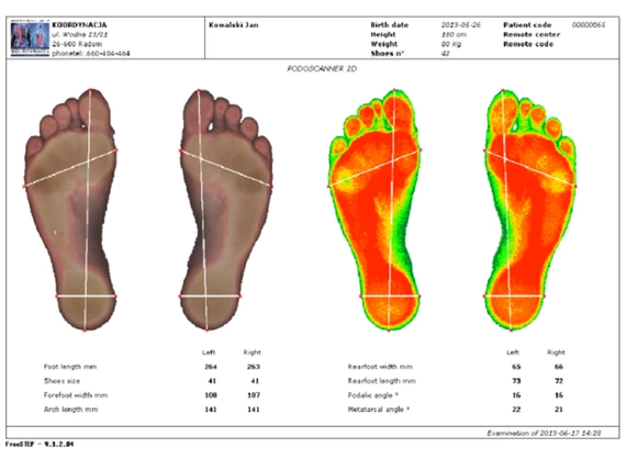 Podoscan 2D FootCAD