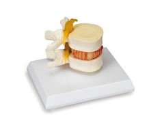 Model symulacji wypadnięcia jądra galaretowatego W22230