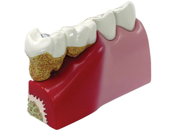 Model zębów 1019539