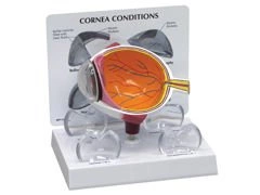 Model przekroju rogówki oka 1019535