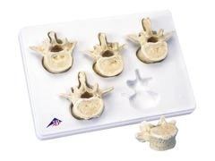 Zestaw 5 kręgów lędżwiowych A792