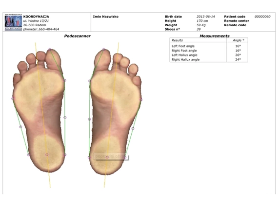 Podoscan 2D FootCAD