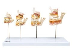 Model faz rozwoju uzębienia D20