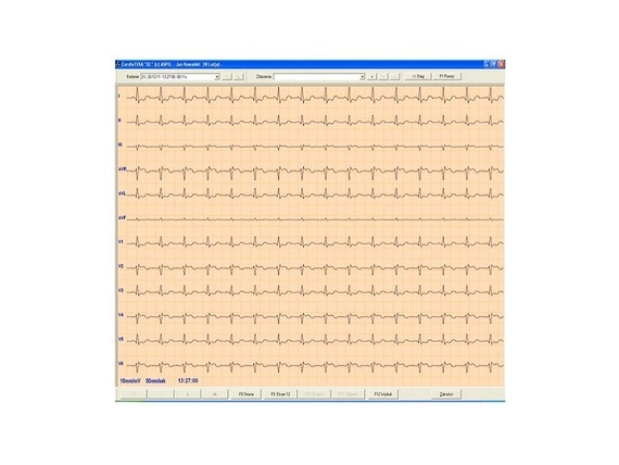 ASPEL ECG CARDIOTEKA v.211SOFTHL7 - Oprogramowanie +HL7