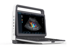 Mobilny aparat USG Zoncare M70 z głowicą liniową